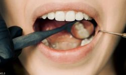 دراسة صادمة.. مشروب شائع قد يسبب سرطان الفم